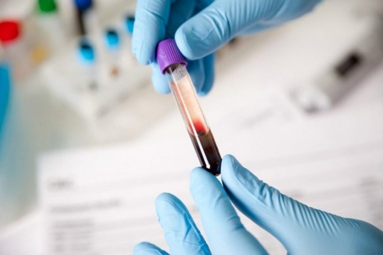 Discover the Benefits of Pregnancy Blood Tests at Home